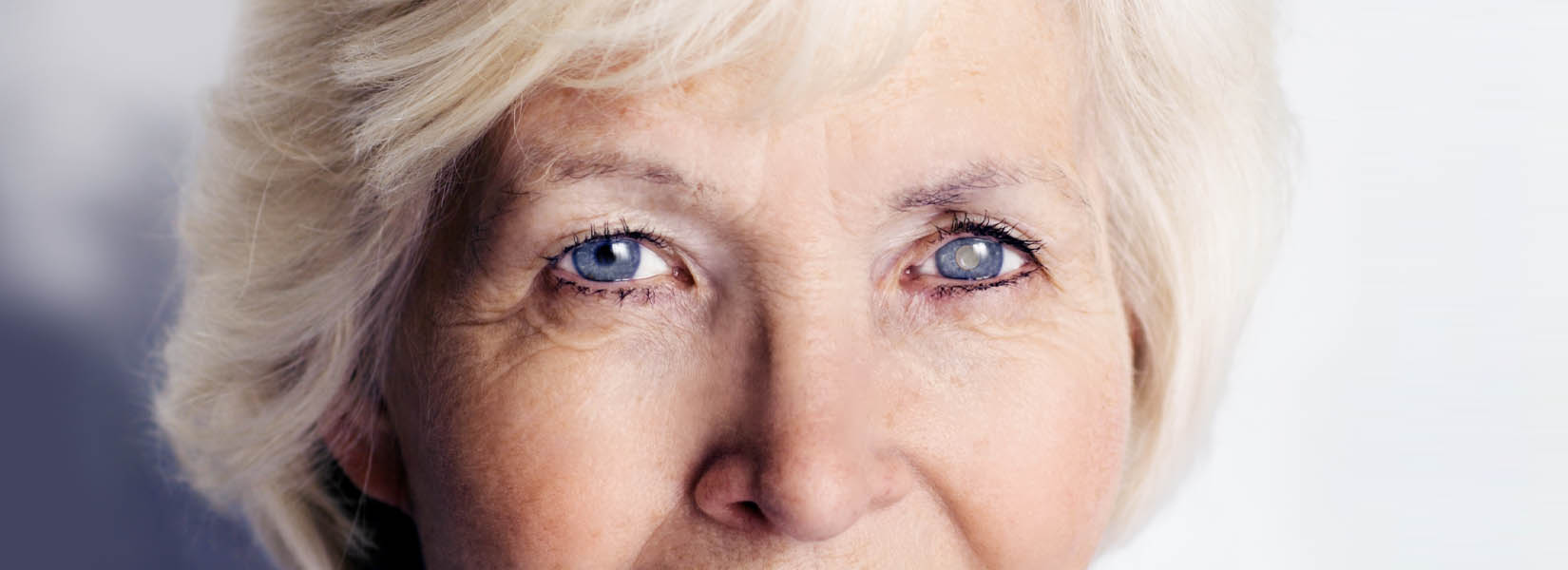 Cataract Surgery in Andover